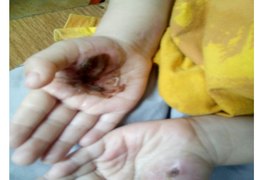Crianças que eram torturadas são resgatadas pelo Conselho Tutelar, em Maceió e Viçosa