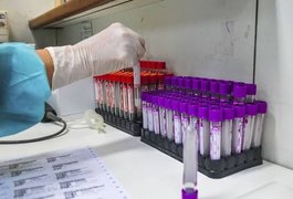 Alagoas tem 87.928 casos da Covid-19 e 2.091 óbitos