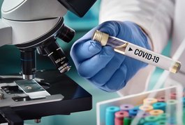 Brasil lidera pesquisas sobre covid-19 entre nações ibero-americanas