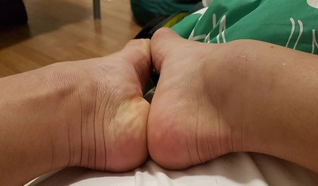 Jade mostra tornozelo inchado: 'Está grande ainda, mas estou bem melhor'