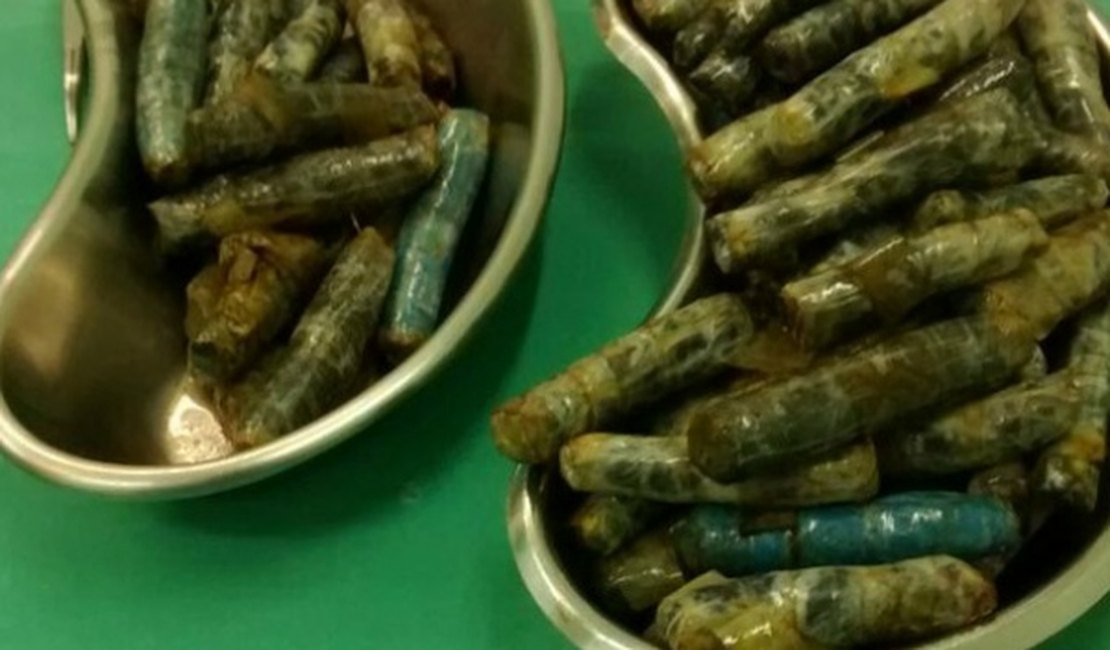 Preso faz cirurgia para retirar quase 1 kg de maconha do estômago