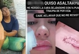 Justiça torna réu jovem que mordeu rosto de turista paraguaia durante tentativa de assalto