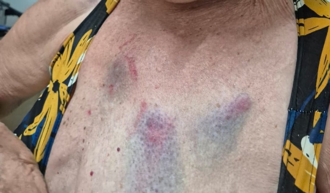 Médica é presa duas vezes em flagrante por agredir idosa de 77 anos em Arapiraca