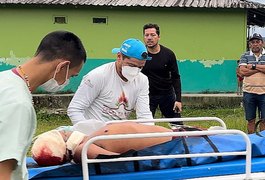 Um indígena é morto e dois são feridos em ataque na Terra Yanomami