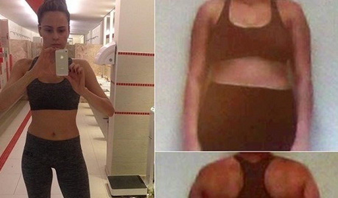 Ana Paula, a nova participante do 'BBB16', conta que já engordou 18kg