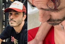 Após ser espancado em assalto, Thiago Rodrigues passa bem e está em casa