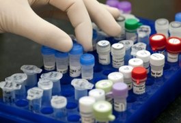 Instituto de Criminalística de Alagoas terá laboratório de DNA próprio até dezembro