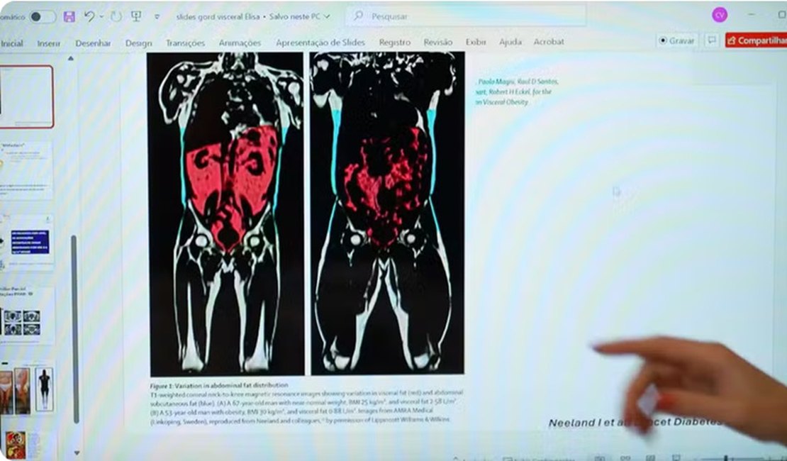 Como identificar a gordura visceral? Medida da cintura pode indicar risco