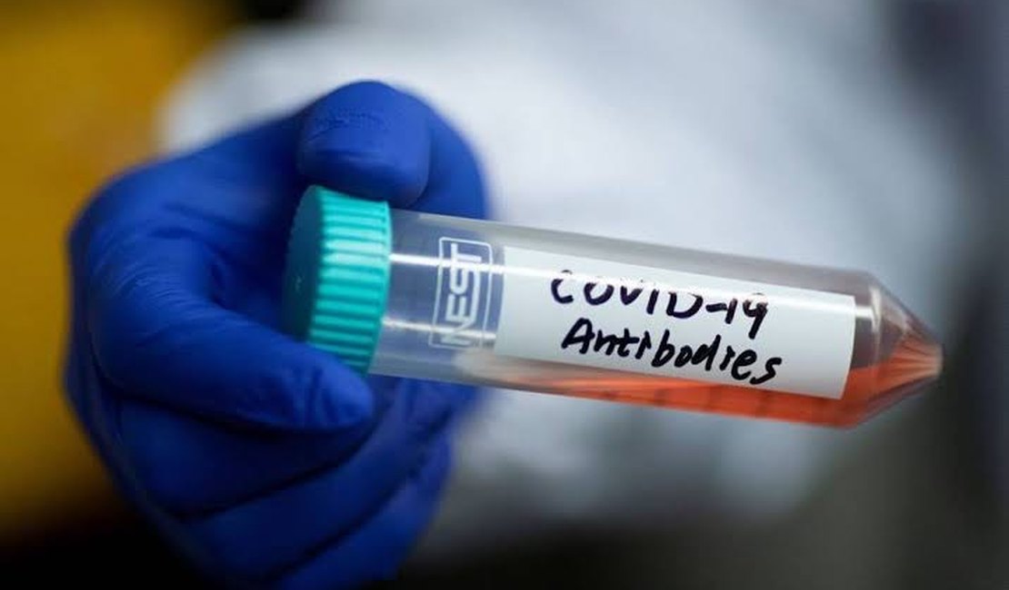 Alagoas confirma mais 481 casos de infecção por coronavírus