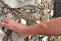 Criança tem perna perfurada por vergalhão enquanto buscava madeira para fogueira, em Arapiraca