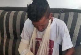 Homossexual é agredido e tem braço quebrado por vizinhos na zona rural de São Miguel dos Campos