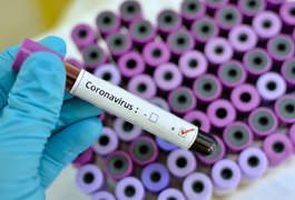 Alagoas registra 05 mortes de 170 novos casos de covid-19