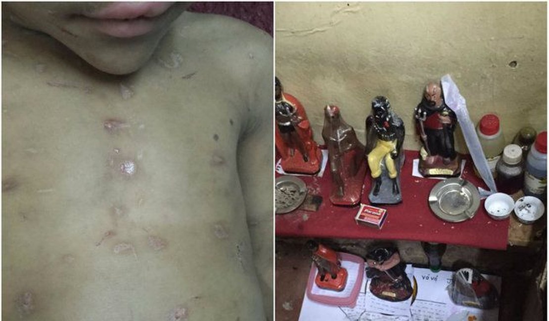 Tios-avós são acusados de torturar menino de 5 anos em suposto ritual de magia