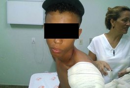 Criminosos efetuam mais de dez disparos de arma de fogo contra menor, em Penedo