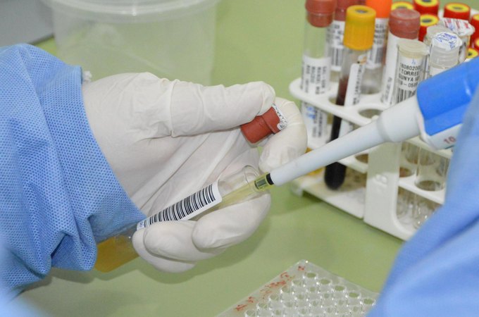 Sesau orienta população sobre riscos, prevenção e tratamento da doença de Chagas