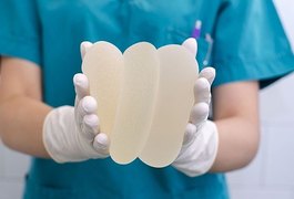 Saiba 9 possíveis riscos de colocar silicone nos glúteos