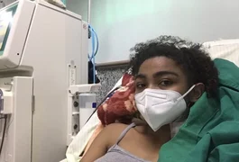 Jovem realiza campanha para custear transplante de rins em Recife