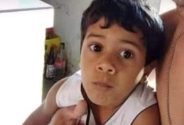 Morre na UE do Agreste a criança baleada na cabeça ao ser feita de escudo humano em Inhapi