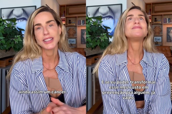 Modelo Mariana Weickert anuncia diagnóstico de câncer de pele e faz alerta: 'Poderia ter sido evitado'