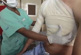 Homem é atraído para encontro por aplicativo e tem corpo queimado em Maceió