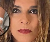 Atriz Mara Carvalho é atropelada por manobrista do carro dela na saída de restaurante