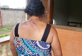 As pessoas gritando e a gente sem poder fazer nada, relata alagoana sobrevivente de acidente com ônibus