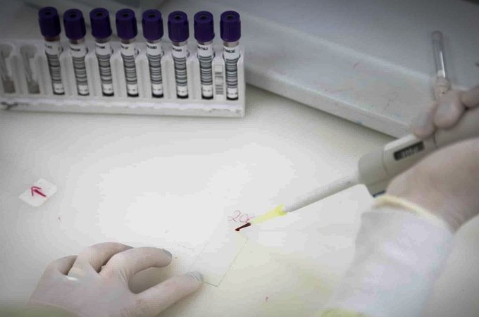Paciente em SP com suspeita de ebola testa positivo para meningite