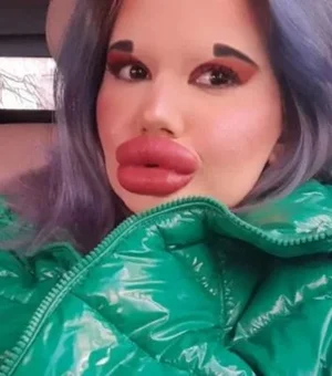 Modelo búlgara anuncia que fará 27° preenchimento labial para ficar parecida com boneca
