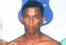 Justiça manda soltar homem que arrancou parte dos lábios da esposa com mordida