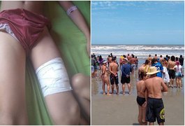 Tubarão causa pânico em praia e deixa menino de 11 anos ferido
