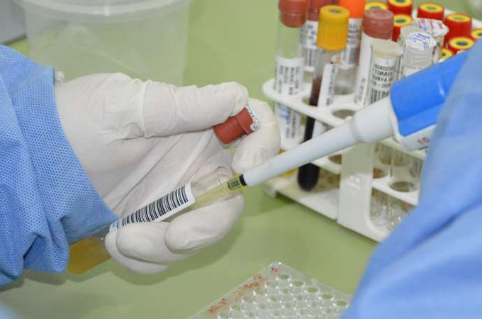 Após investigação, prefeitura descarta 2º caso de meningite B, em União dos Palmares