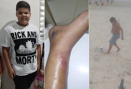 Menino de 12 anos morre após fraturar tornozelo no futebol e família acusa hospitais de negligência: 'dor e revolta'