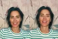O alerta de Carolina Dieckmmann após ser internada