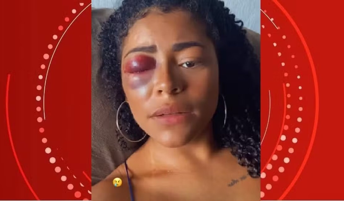 Mulher grava vídeo com olho roxo e denuncia namorado por agressão