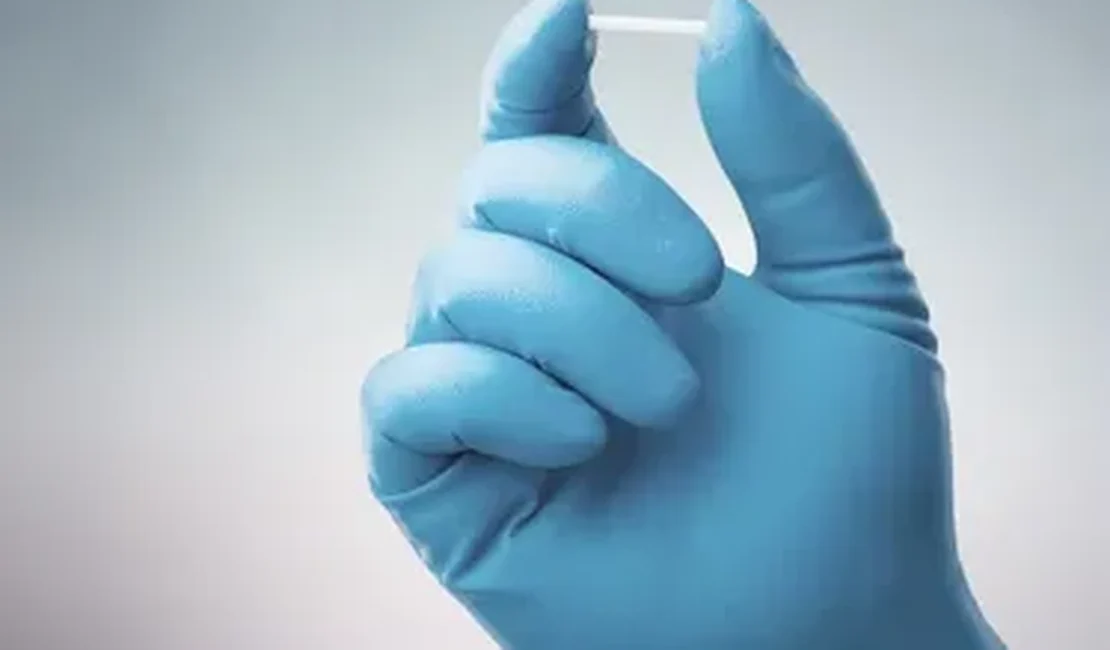 Implante contraceptivo de até R$ 4 mil que dura até três anos chega ao SUS