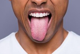 12 sinais de alerta na língua que jamais deve ignorar