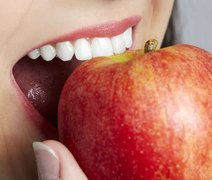 Saiba 5 mitos sobre clareamento odontológico