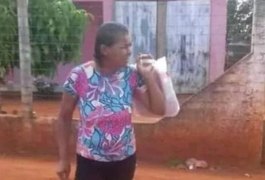 Mulher esfaqueada por homem com transtornos mentais no Sítio Carrasco não resiste e morre no HEA