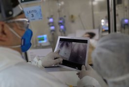 Estudo relata morte de brasileiro vítima da covid após reinfecção por diferentes variantes