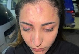 VÍDEO: Vocalista da Banda Sedutora é espancada por homem e mulher antes de show