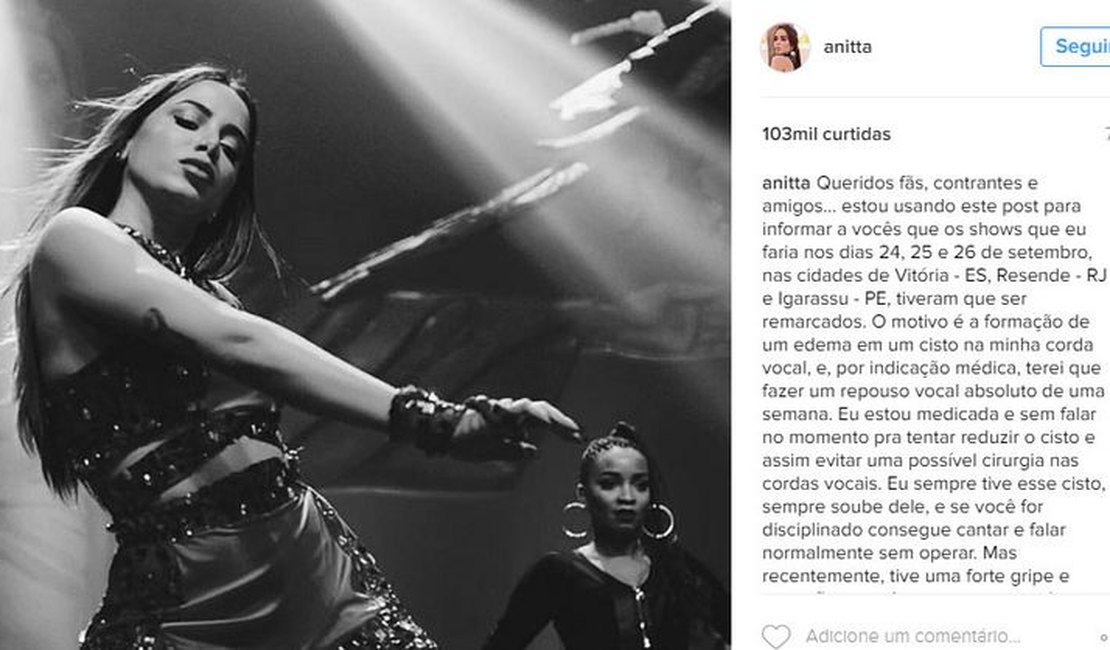 Anitta cancela shows devido a edema e cisto nas cordas vocais
