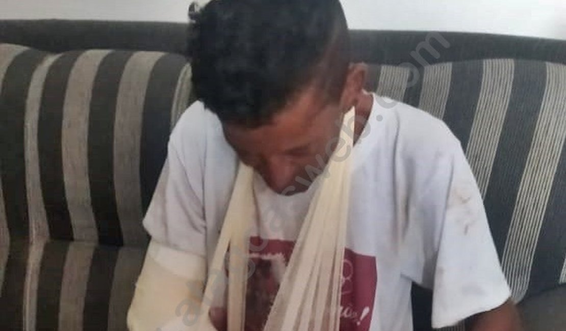 Homossexual é agredido e tem braço quebrado por vizinhos na zona rural de São Miguel dos Campos