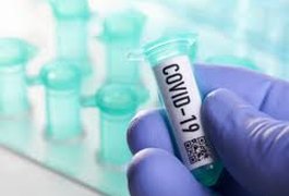 Covid-19: Arapiraca registra mais de 5 mil casos confirmados e 119 mortes