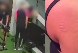 Mulher denuncia assédio após ser mordida e agarrada por instrutor de academia em Pernambuco