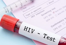 Teste de vacina contra HIV tem bons resultados