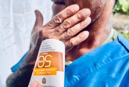 Médico do Hospital Ib Gatto destaca importância do diagnóstico precoce do câncer de pele