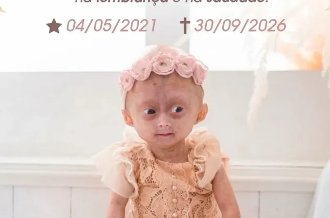 Influencer mirim com ﻿síndrome rara, Elis Lima Carneiro morre aos 5 anos