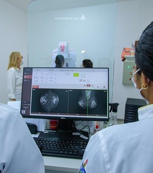 Centro de diagnóstico e imagem da Uncisal é referência na realização de mamografias pelos SUS