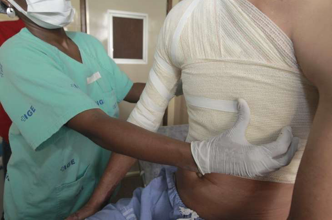 Homem é atraído para encontro por aplicativo e tem corpo queimado em Maceió