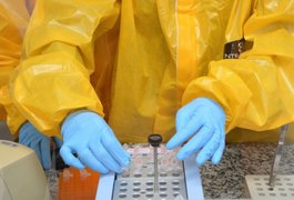 Estado vai ampliar exame de RT-PCR para alagoanos com síndrome gripal